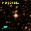 HD 304581