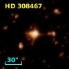 HD 308467