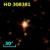 HD 308381