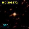HD 308372