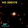 HD 308378