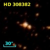 HD 308382