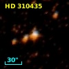 HD 310435