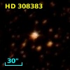 HD 308383