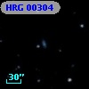 HRG 00304
