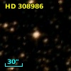 HD 308986