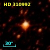 HD 310992