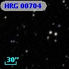 HRG 00704