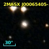 6dFGS gJ000654.1-542242