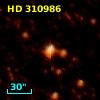 HD 310986