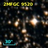 2MFGC 9520