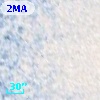 Cl* NGC 5139    WFI  124490