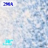 Cl* NGC 5139    WFI  319310