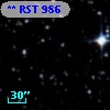 ** RST   986
