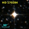 HD 170284