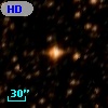 HD 155510