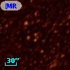 [MR72] 14