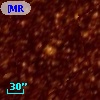 [MR72] 23
