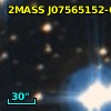 2MASS J07565152-6048116