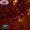 [RP2006] J051815-691621