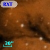 RXT 11