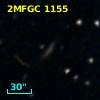 2MFGC 1155
