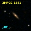 2MFGC 1581