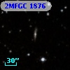 2MFGC 1876