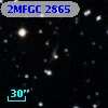 2MFGC 2865