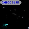 2MFGC 3175