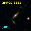 2MFGC 3551