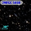 2MFGC 5010