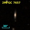 2MFGC 7657