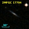 2MFGC 17704