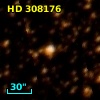 HD 308176