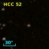 HCC 52
