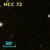 HCC 72