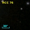 HCC 76