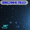 [DRG2004] 76:13