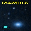 [DRG2004] 81:20