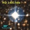 HD 148156b