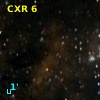 CXR  6