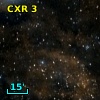 CXR  3