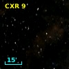 CXR  9