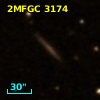 2MFGC 3174
