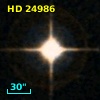 HD  24986