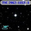 TYC 2862-1157-1