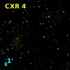 CXR  4