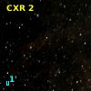 CXR  2
