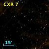 CXR  7